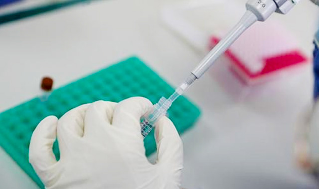 FDASUNGO又协助浙江生物公司2款新冠病毒检测试剂盒入选商务部出口白名单